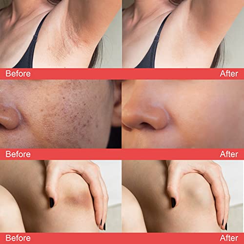 Saam Renewal Face Cream كريم سام لتجديد البشرة